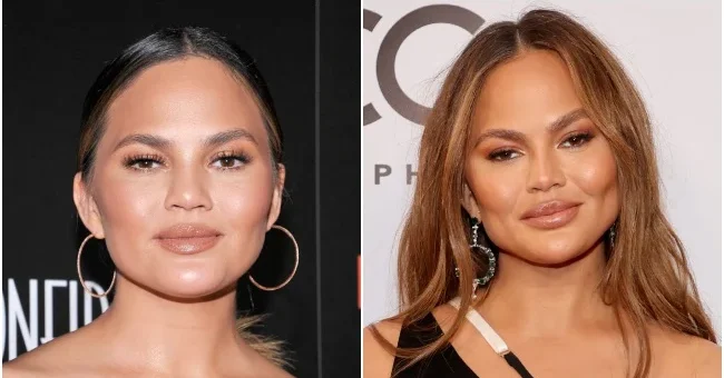 Before and after photos showcasing a woman's face, highlighting the results of Buccal Fat Removal Before and After 10 Years.