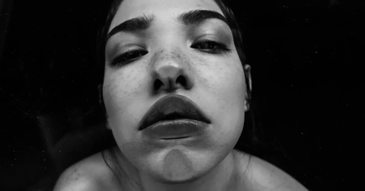 Fat Grafting Cleft Chin