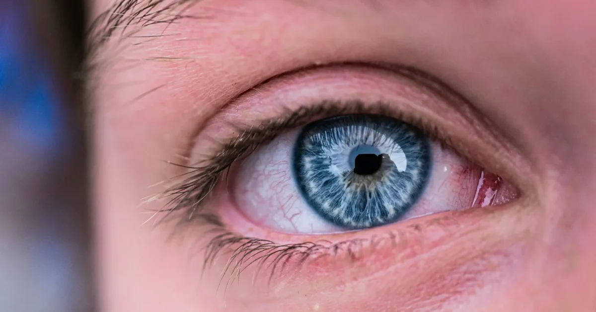 Eyes are important part of a body so question is how to improve the vision of eyes or how to take care of them.